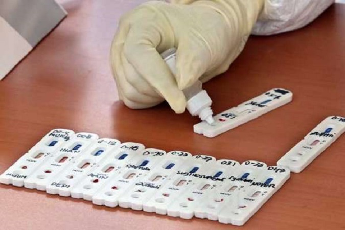 Awas, Alat Rapid Test Antigen Ilegal Beredar di Jateng